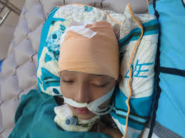 Chấn thương đầu ở trẻ em - Hình ảnh minh họa